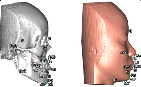 Cirurgia Ortognástica